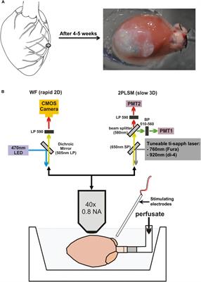 Characterization of Electrical Activity in Post-myocardial Infarction Scar Tissue in Rat Hearts Using Multiphoton Microscopy